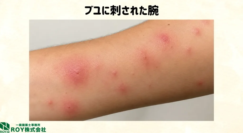 ブユに刺された腕
