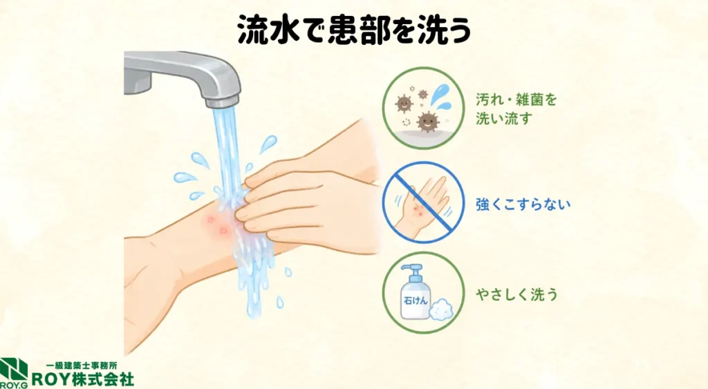 ブユに刺されたときの応急処置・流水で患部を洗う